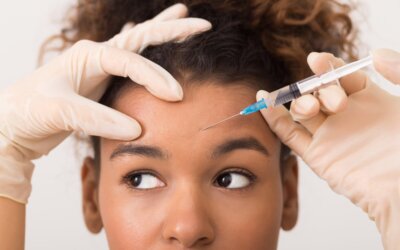 Botox for Crow’s Feet, Before and After: How Effective Is Treatment?
